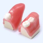 Блок до моделі видалення ретинованих зубів мудрості