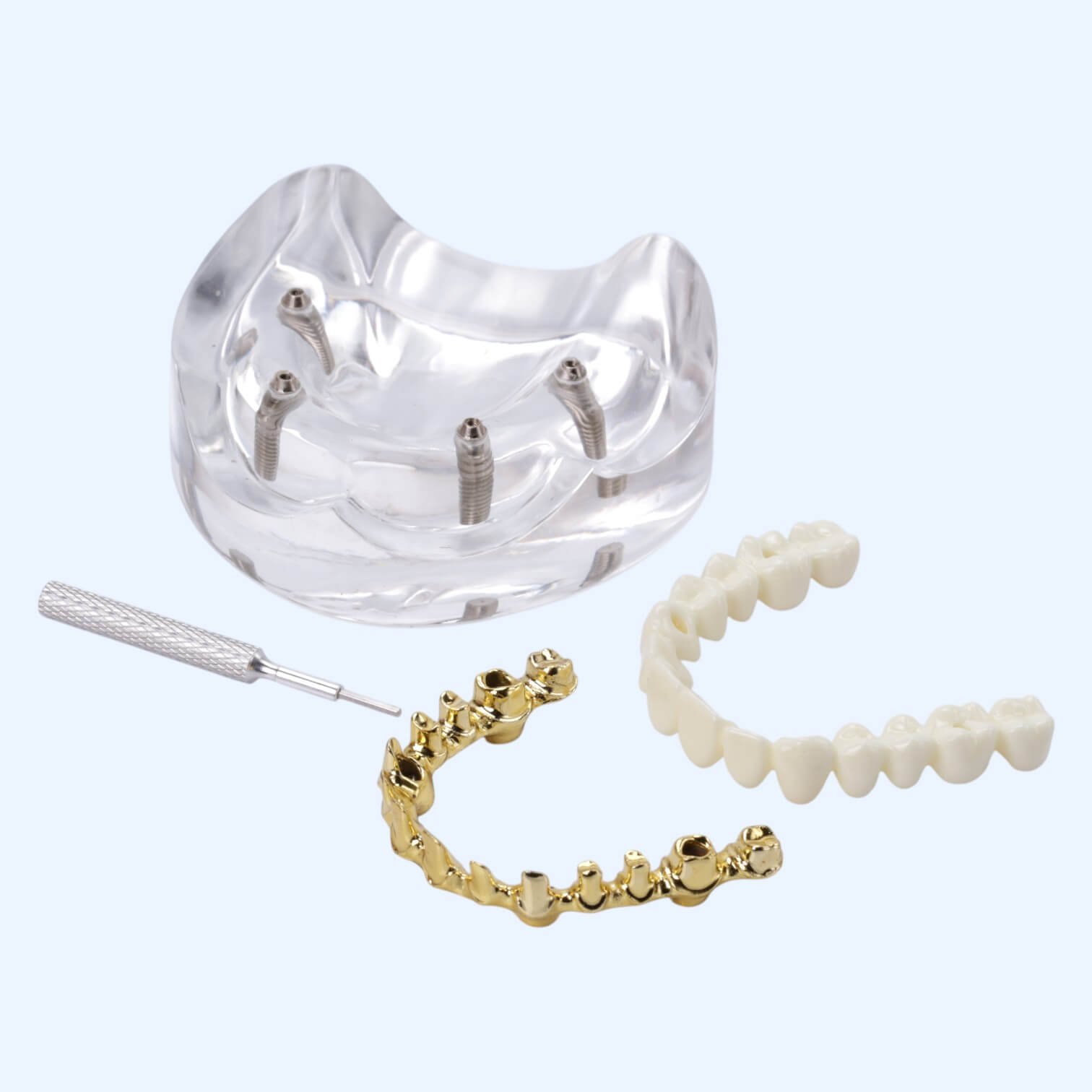 Модель протез на імплантатах на золотій балці FP 1 знімний з викруткою