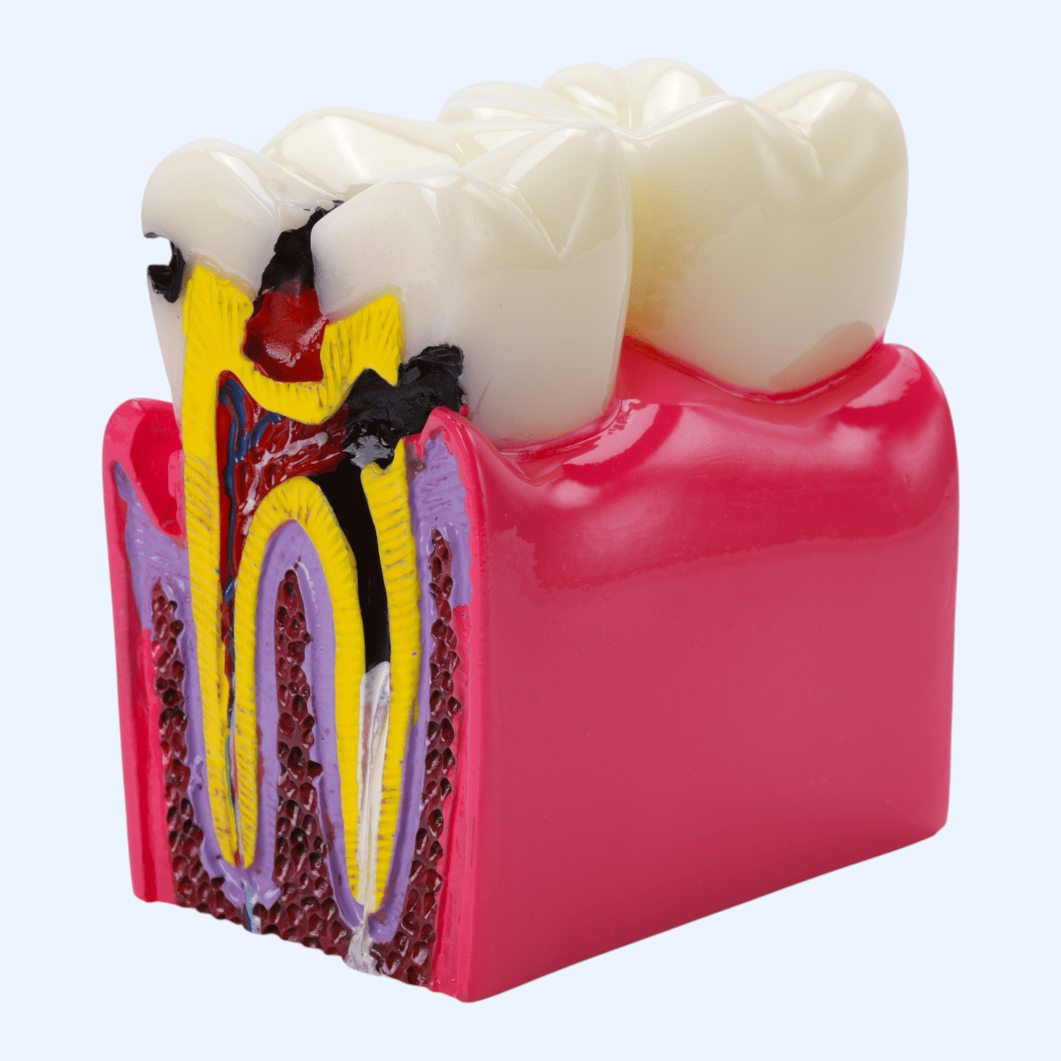 Модель зуб в розрізі